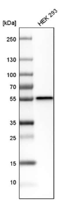 Dysbindin Antibody, Novus Biologicals:Antibodies:Primary Antibodies